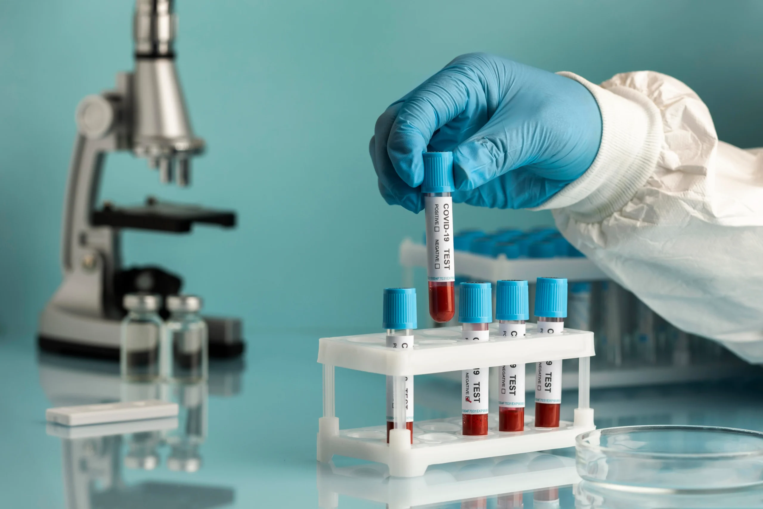 hand-with-protective-gloves-holding-blood-samples-covid-test