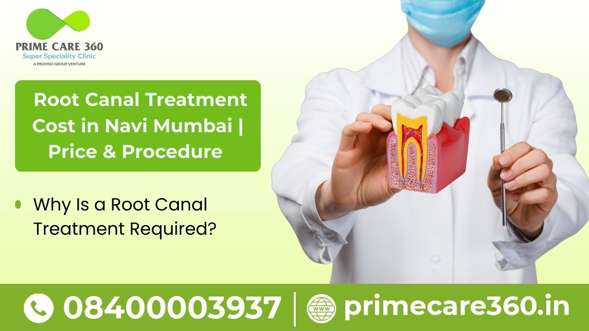 Root Canal Treatment