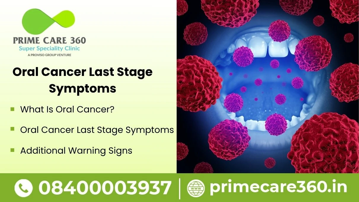 Oral Cancer Last Stage Symptoms