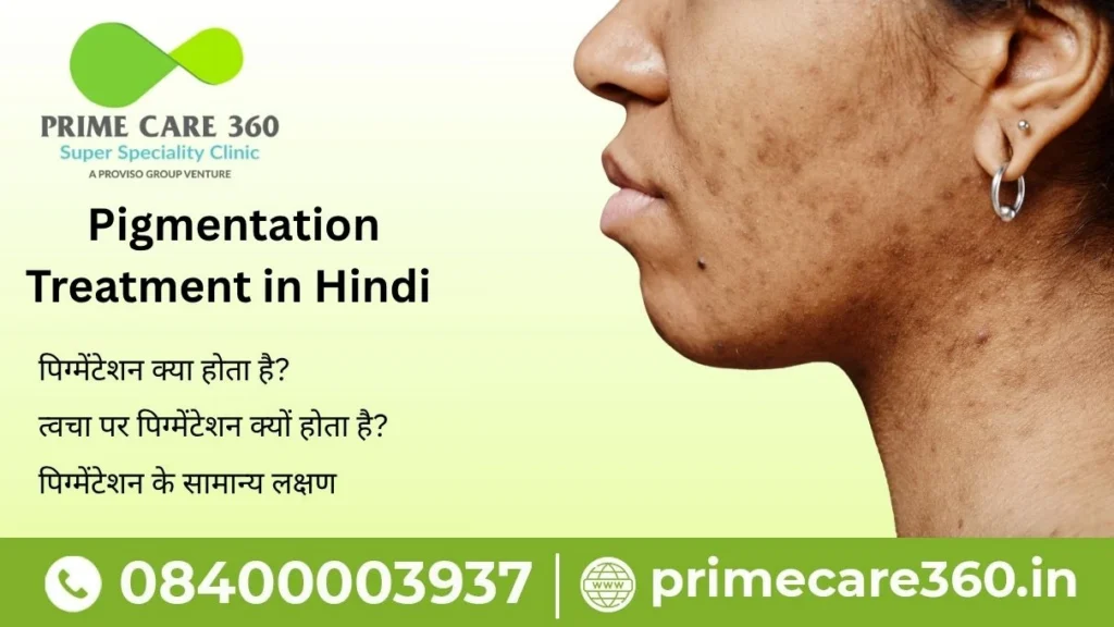 pigmentation treatment in hindi
