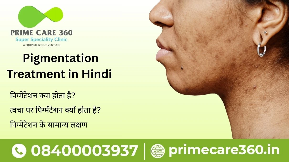 pigmentation treatment in hindi​