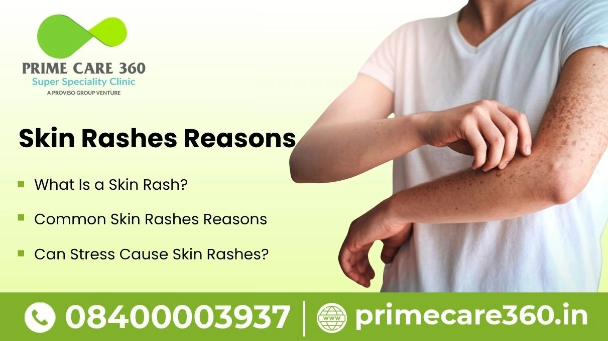 skin rashes reasons